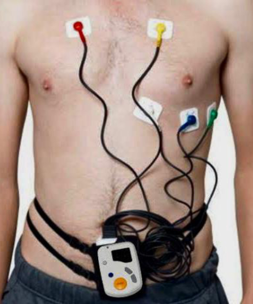 Holter De 24 Y 48 Hrs.