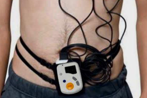 Holter De 24 Y 48 Hrs. en CDMX